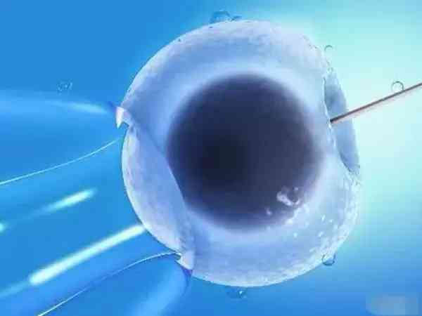 临沂试管私立医院